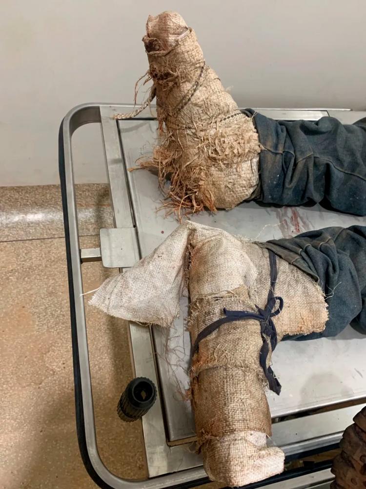 Criminoso morto em confronto na operação Canguçu usava sacos amarrados aos pés para tentar despistar a polícia