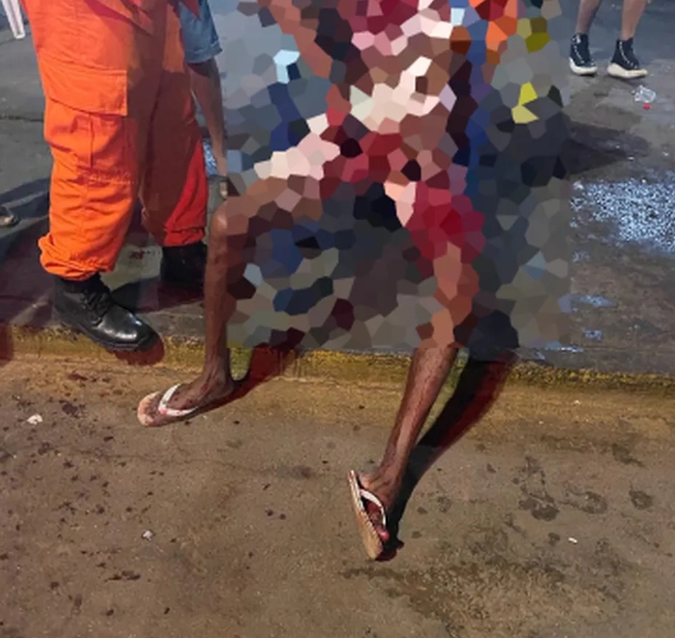 Jovem é esfaqueado, mas consegue caminhar para pedir socorro em bar de Palmas