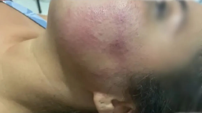 VÍDEO: Oficial de Justiça derruba mulher com tapa no rosto durante festa e vítima fica com corte e hematoma